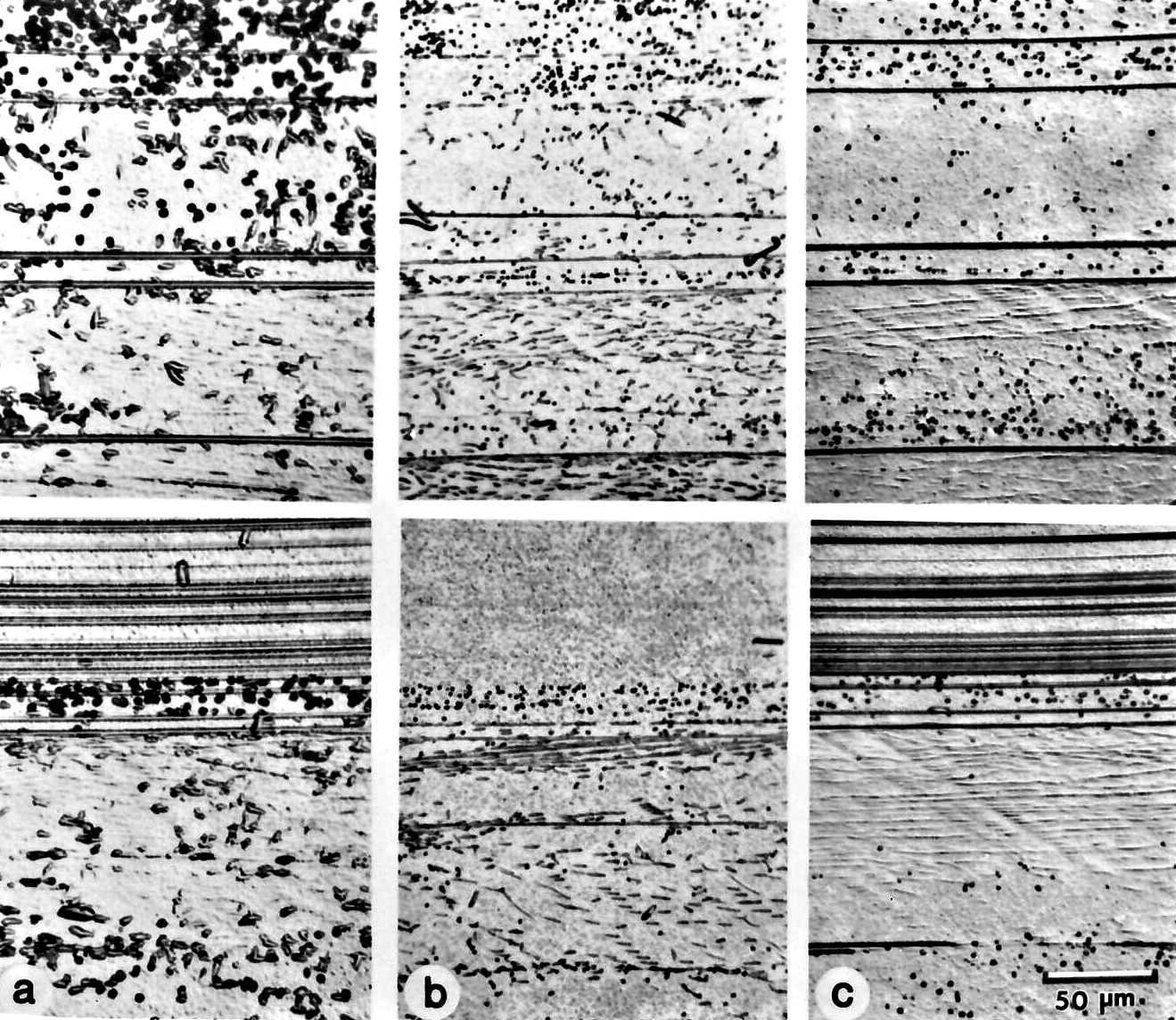 Anodic defect ertching in Si