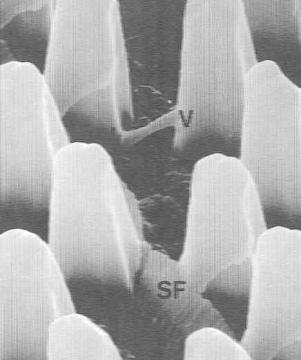 Inverted trench with dislocation