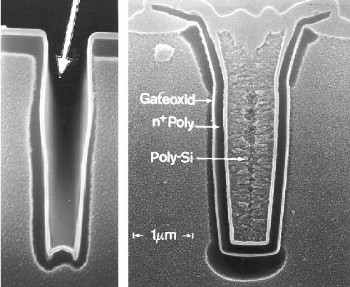 Trecnh implantation