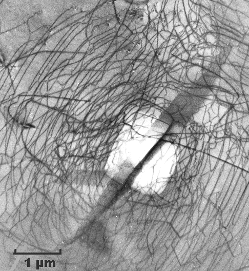 Dislocations in silicon