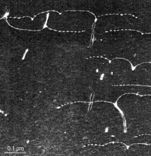 Dislocations stuck at precipitates