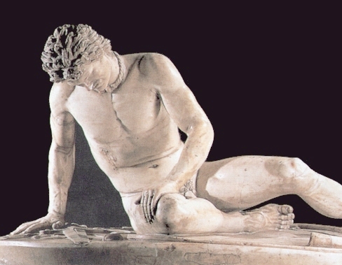 Dying Gaul