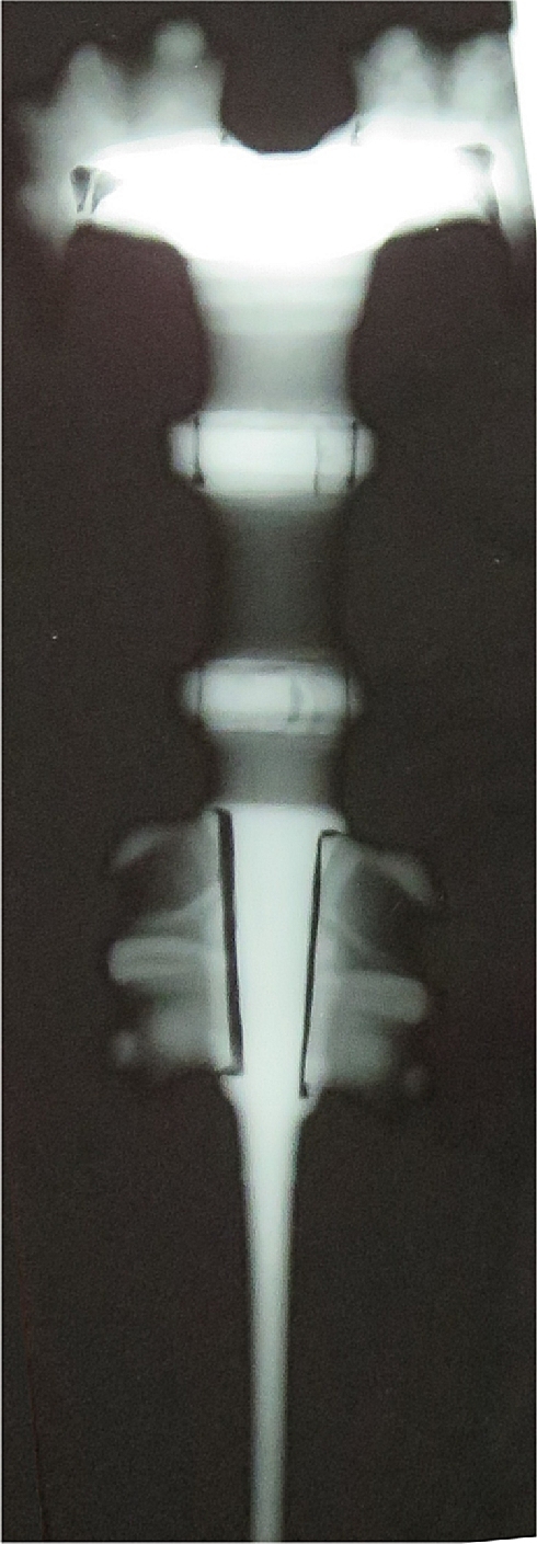 Luristan sword H. Foell; X-ray