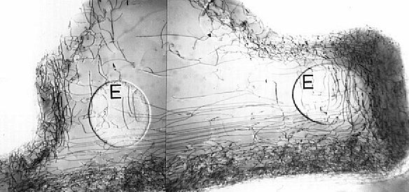 TEM of oxide edge dislocations